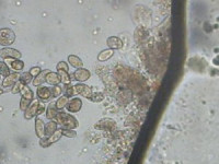Хилоденеллез (Chilodonellosis).