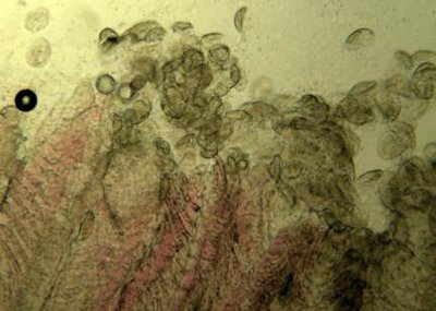 Хилоденеллез (Chilodonellosis).